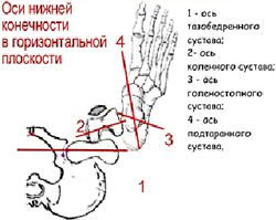 Ротационные дисплазии