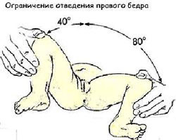 Клинические симптомы