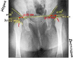 Клинические симптомы