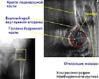 Ультразвуковая диагностика