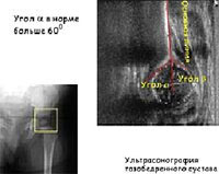 Ультразвуковая диагностика