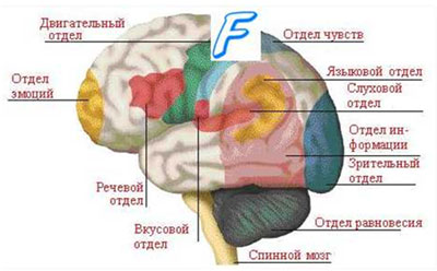 Геморрагический инсульт